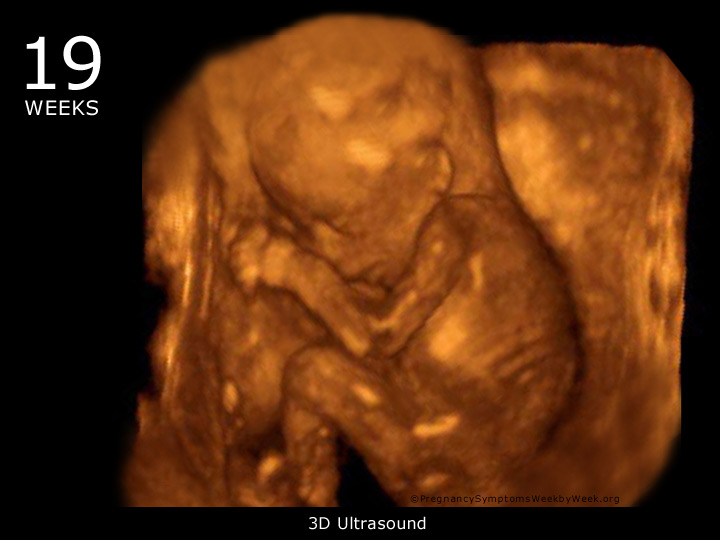 What to Expect with Ultrasound Done at 19th Week of Pregnant with Pictures