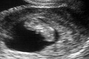 What to Expect with Ultrasound 7 Weeks in Pregnancy?