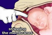 Membrane Stripping