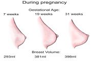 Breast Changes During Pregnancy