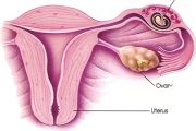 What Does an Ectopic Pregnancy Feel Like?