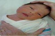 Torticollis Baby: Symptoms, Causes & Treatments
